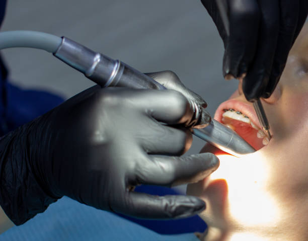 istock A woman at a dentist's appointment to replace arches with braces. 1285211413