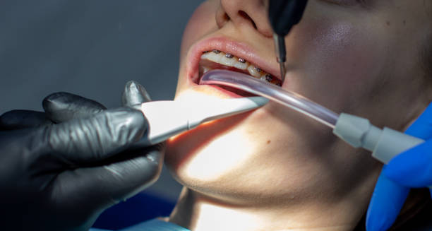 istock A woman at a dentist's appointment to replace arches with braces. 1285211956
