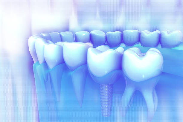 Artificial teeth on a white background with copy space. Dentist appointment, dentistry instruments and dental hygienist checkup concept with teeth model dentures