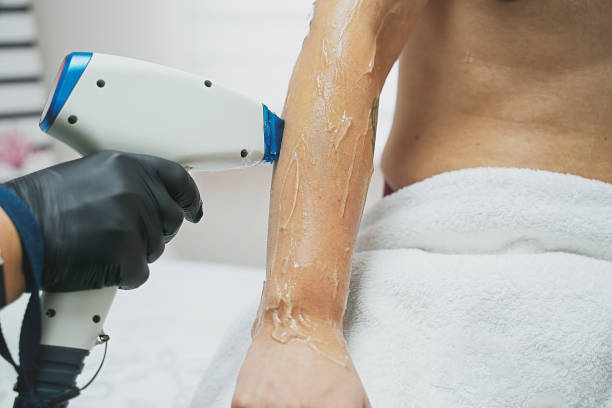 istock Laser hair removal on man arms. Epilation process 1285347148