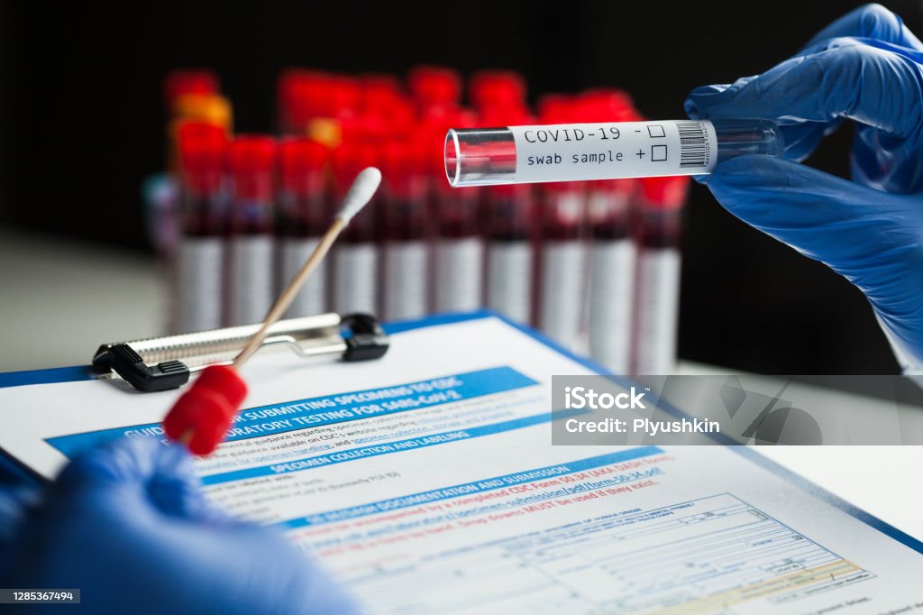 Coronavirus PCR test rt-PCR COVID-19 virus disease diagnostic test, lab technician wearing blue protective gloves holding test tube with swabbing stick, swab sample equipment kit & CDC form specimen submitting guidelines PCR Device Stock Photo