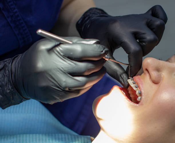 istock A woman at a dentist's appointment to replace arches with braces. 1285401788