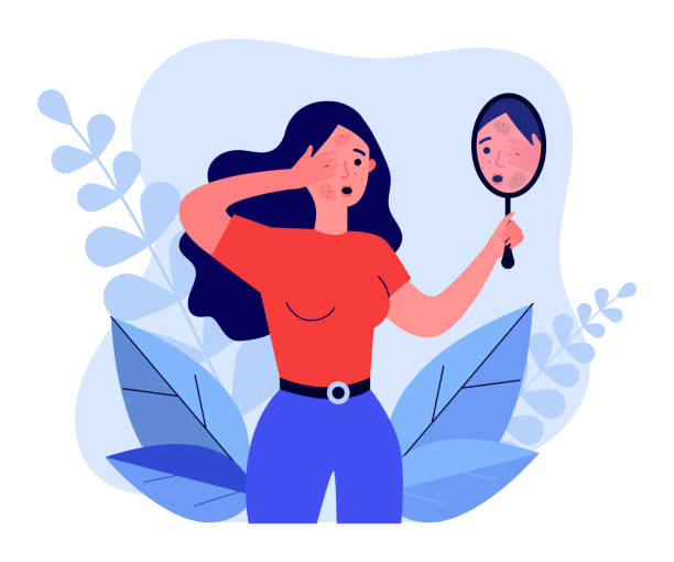 Woman finding rash on her face Woman finding rash on her face. Upset girl looking in mirror flat vector illustration. Acne, skin problem, disease symptom concept for banner, website design or landing web page woman mirror stock illustrations