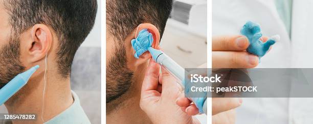 Set Of Making A Custom Earplug For A Man Stages Of Manufacturing Earplugs Doctor Makes Custom Molded Ear Plugs For The Patient Ear Closeup Stock Photo - Download Image Now