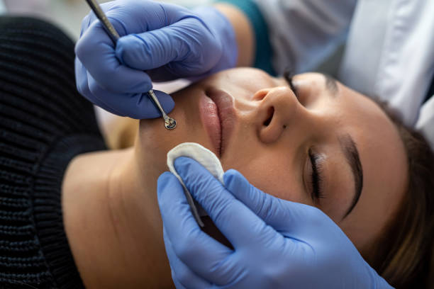 istock Cosmetologist using mechanical instrument spoon uno removing and blackhead cleansing on face 1285485928
