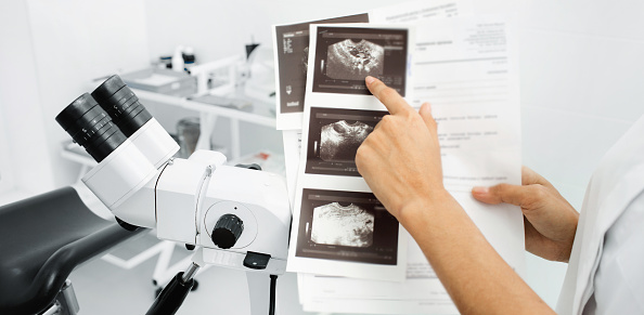 ultrasound examination of the ovaries and uterus. Results of transvaginal ultrasound close-up. Diagnosis of uterine diseases and analysis of ovarian diseases