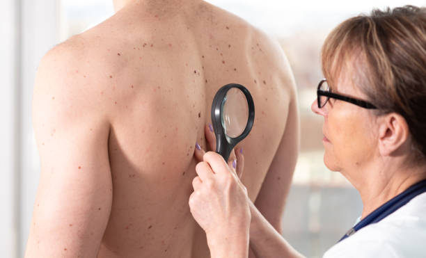 istock Dermatologist examining the skin of a patient 1285593337