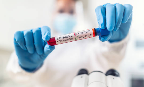istock A positive coronavirus test held in hands by a laboratory staff. 1285615989
