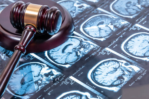 JUDGE'S DECK TOGETHER WITH MAGNETIC RESONANCE. CONCEPT OF JUSTICE APPLIED TO HEALTH. FOCUS SELECTIVE. stock photo