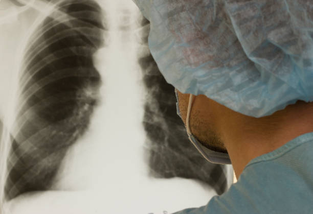 un médecin examine une radiographie du poumon d’un patient infecté par le coronavirus covide-19, pneumonie. rayons de lumière. fluorographie - radiogram photographic image photos et images de collection