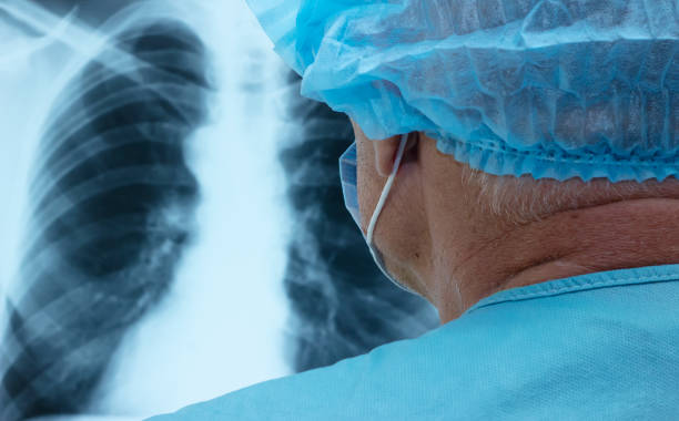 istock Doctor examines an X-ray of a lung 1285942440