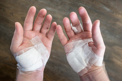 Two Bandaged Hands Stock Photo - Download Image Now - Bandage 