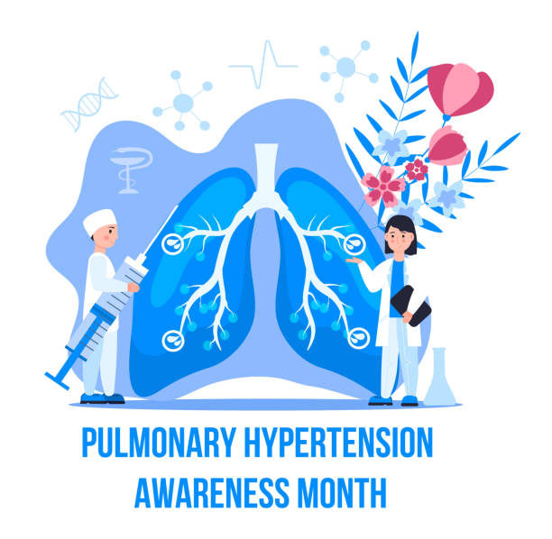 Pulmonary Hypertension awareness month is celebrated in November. Pulmonary fibrosis, tuberculosis illustration for website, app, banner. Tiny doctors treat Pulmonary Hypertension awareness month is celebrated in November. Pulmonary fibrosis, tuberculosis illustration for website, app, banner. Tiny doctors treat, scan internal organ. pulmonary artery stock illustrations