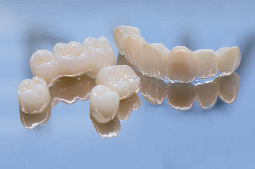 Metal Free Ceramic Dental Crowns. Ceramic zirconium in final version. Staining and glazing. Precision design and high quality materials.