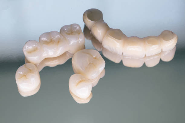 istock Ceramic zirconium in final version. Staining and glazing. Precision design and high quality materials. Metal Free Ceramic Dental Crowns 1286083452