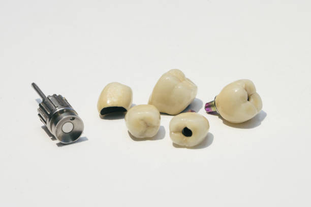 Dental services. Installation of ceramic teeth of a person