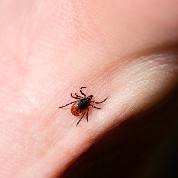 istock small tick on humans skin 1286094298