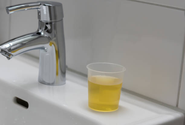 Urine in a plastic cup near faucet of white sink. Urine in a plastic cup for analysis near faucet of white sink. Annual inspection of woman health at the gynecologist in the toilet. tuermaric mouth wash stock pictures, royalty-free photos & images