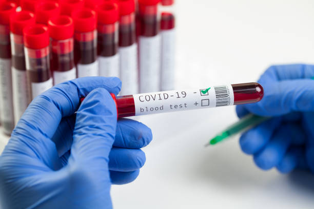 arzt oder laborwissenschaftler, der ein reagenzglas mit coronavirus-patientenblutprobe kenntiert - dna epidemiology patient science stock-fotos und bilder