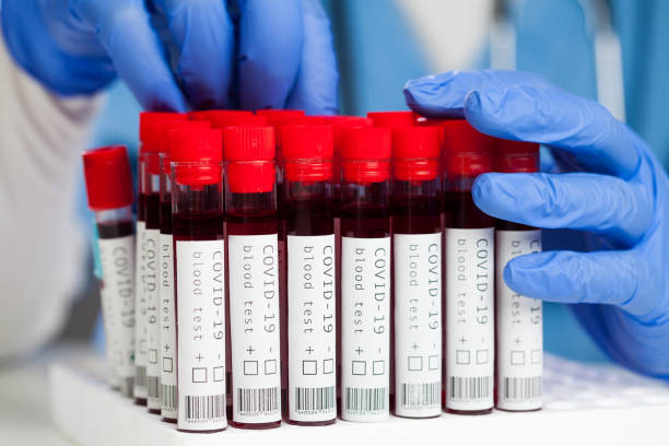 científico de laboratorio o técnico médico examinando muestras de sangre para pacientes con coronavirus covid-19 - dna epidemiology patient science fotografías e imágenes de stock