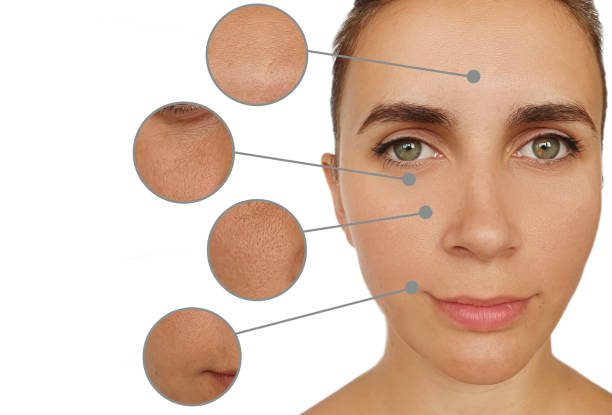 istock woman face wrinkles before and after treatment collage 1286475149