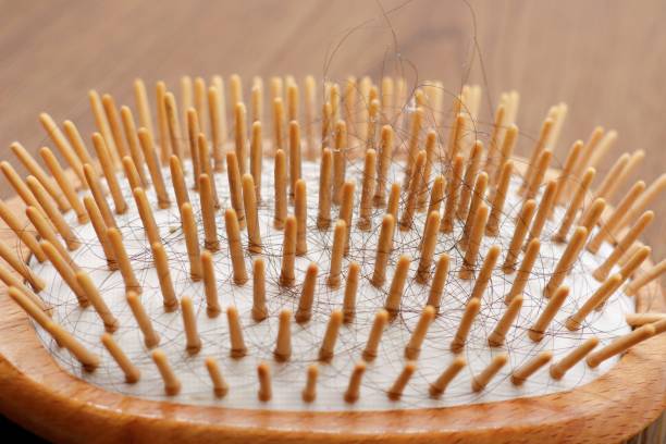 istock Brush with hair loss 1286509778