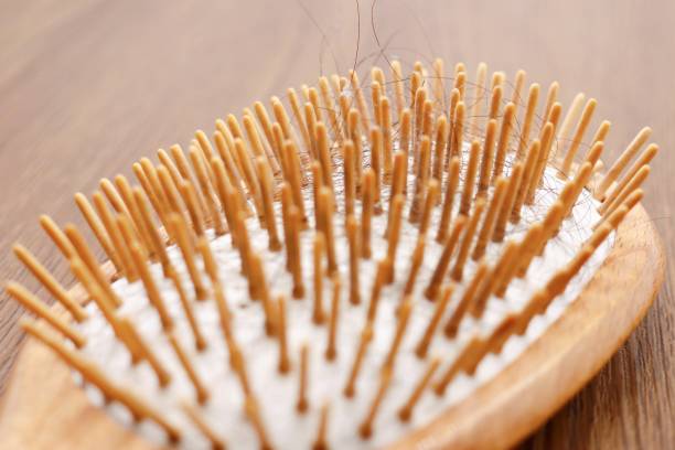 istock Brush with hair loss 1286509788