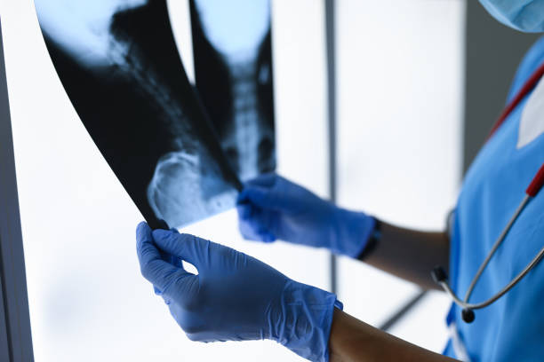 le docteur avec des gants retient deux plan rapproché de rayons x - radiogram photographic image photos et images de collection