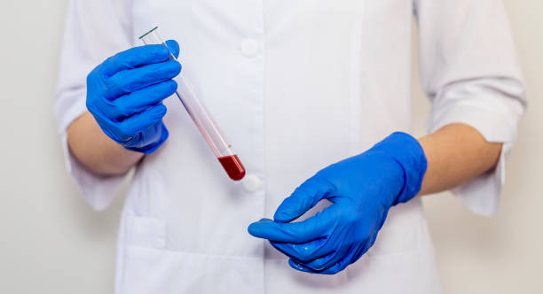 blood sample in test tube for analysis in doctor hands close up - blood red blood cell blood cell blood sample imagens e fotografias de stock