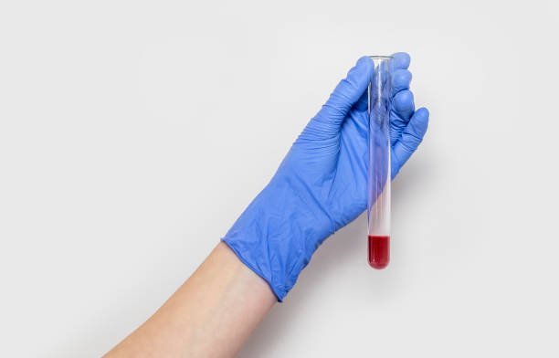 blood sample in test tube for analysis in doctor hands close up isolated over white background - blood red blood cell blood cell blood sample imagens e fotografias de stock