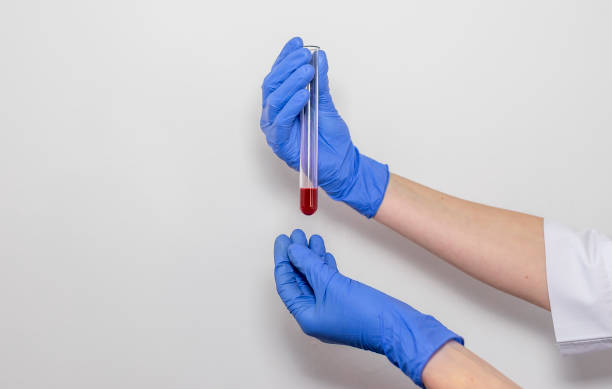 blood sample in test tube for analysis in doctor hands close up isolated over white background - red blood cell imagens e fotografias de stock