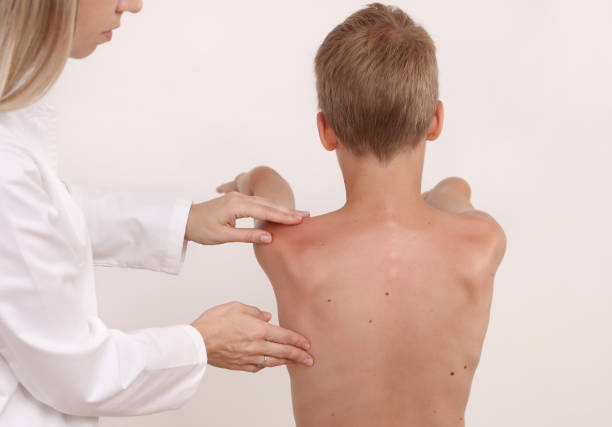 istock Physiotherapist exam for teenage boy. Manual Muscles Tests and Posture Checking . Preventive Health Care Visits in Children 1287077041