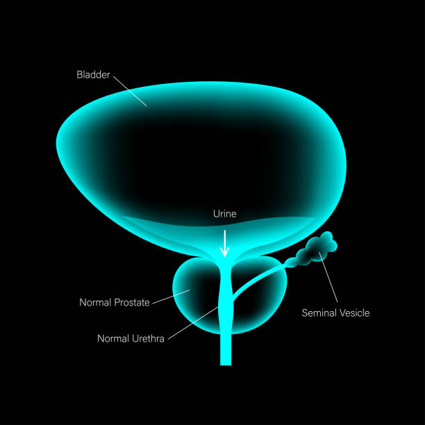 Prostate Problems Graphics 70+ Prostate Xray Stock Illustrations, Royalty-Free Vector Graphics ...