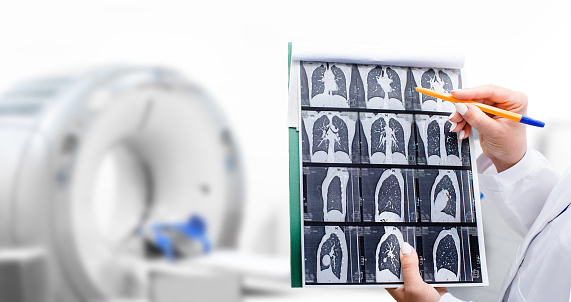 Radiologist showing tomography scan of a patient's lungs over of CT machine. Treatment of lung diseases, pneumonia, coronavirus, covid, cancer, tuberculosis