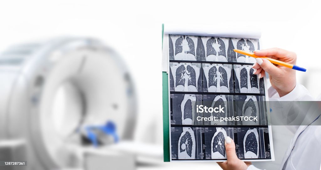 Radiologist showing tomography scan of a patient's lungs over of CT machine. Treatment of lung diseases, pneumonia, coronavirus, covid, cancer, tuberculosis Lung Cancer Stock Photo