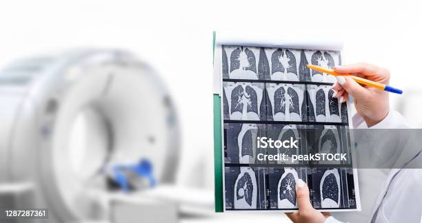 Radiologist Showing Tomography Scan Of A Patients Lungs Over Of Ct Machine Treatment Of Lung Diseases Pneumonia Coronavirus Covid Cancer Tuberculosis Stock Photo - Download Image Now