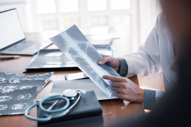 istock The doctor is analyzing and clarifying images of the patient's lung X-rays. 1287339902