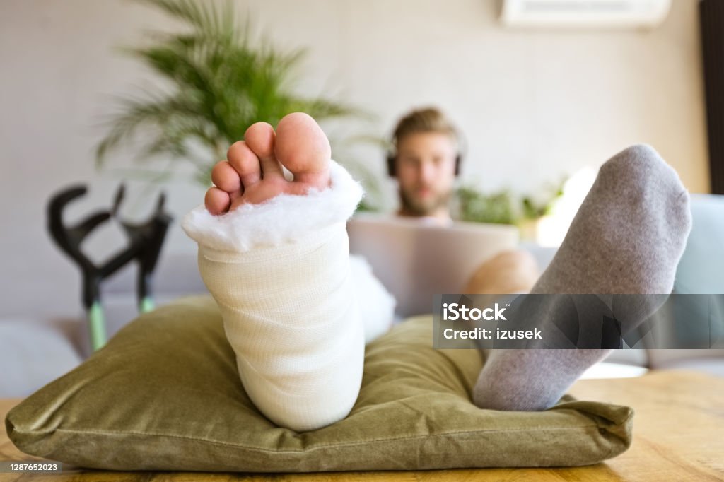 Young man with broken leg during video call Young man with broken leg in plaster cast lying down on sofa at home, using laptop and having video conference. Focus on leg. Broken Leg Stock Photo