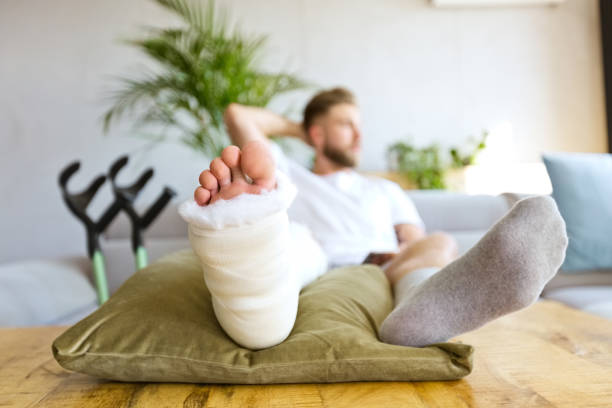 Young man with broken leg using smart phone Young man with broken leg in plaster cast lying down on sofa at home, holding smart phone in hand and looking through window. Focus on leg. crutch stock pictures, royalty-free photos & images