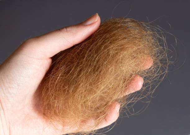 istock Ball of hairs 1287677246