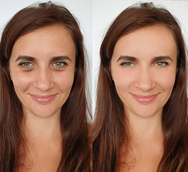 istock woman face wrinkles before and after treatment 1287807307