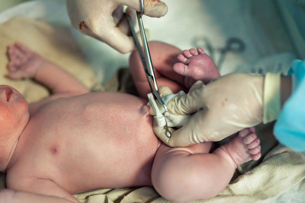 클로즈업 의사 산부인과 간호사는 신생아에게 의료 가위를 가진 탯줄을 절단합니다. 아이를 출산하는 의과 의사. 새로운 인간의 삶이 시작됩니다. 출산 노동출산병원 - labour room 뉴스 사진 이미지