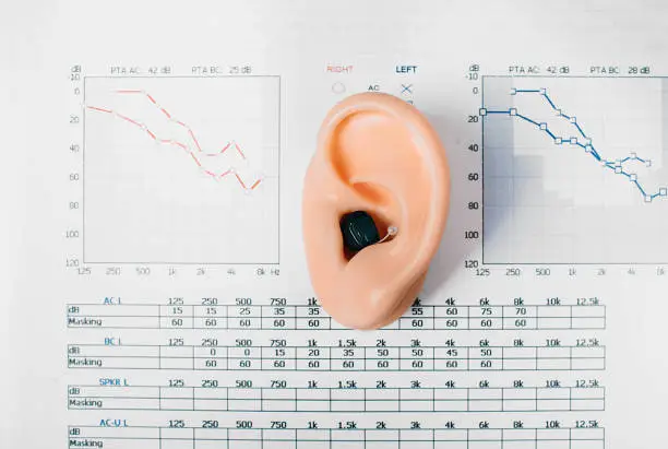 Photo of Audiometry, diagnosis of hearing impairment. Close-up of the hearing aid and ear model against the background of auditory test results