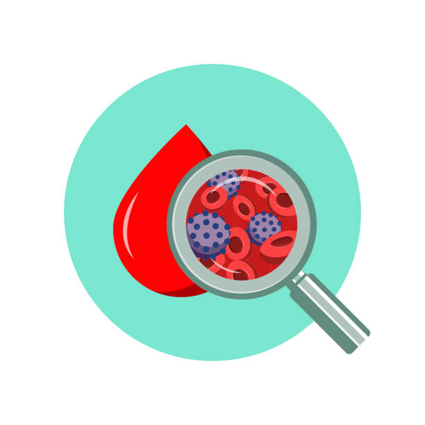 ilustrações de stock, clip art, desenhos animados e ícones de blood cell testing for aids and hiv. cells infected with the human immunodeficiency virus. medical diagnostics using a blood drop sample. vector illustration isolated on a blue background - blood red blood cell blood cell blood sample