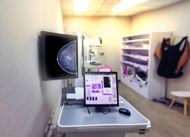 máquina de mamografía o mamografía para mujeres en el hospital aisladas sobre fondo borroso. - breast cancer awareness fotografías e imágenes de stock