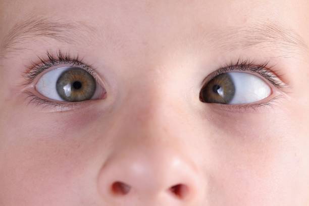 istock Child's face with squint and freckles on nose. 1288046571