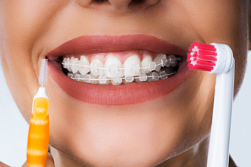 Soportes dentales de limpieza femenina en la boca photo