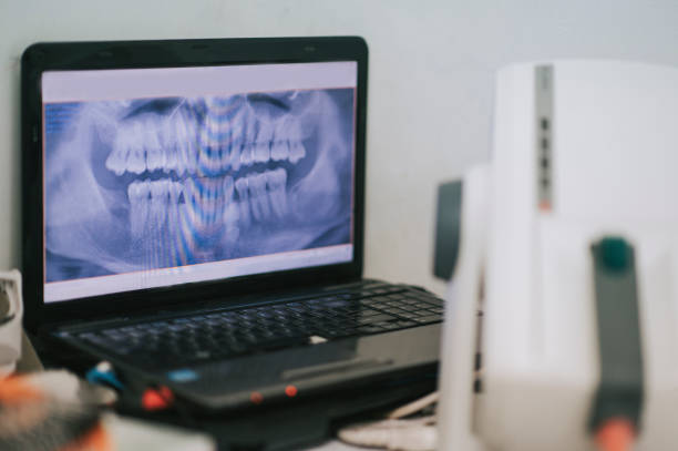 istock X-ray screen on laptop at dental office 1288230265