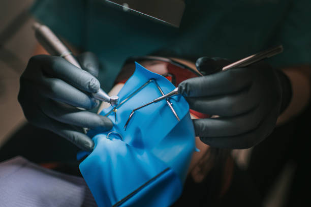 Asian chinese male dentist looking through microscope on patient's teeth in dentist's office Root canal treatment Asian chinese male dentist looking through microscope on patient's teeth in dentist's office Root canal treatment surgical light stock pictures, royalty-free photos & images