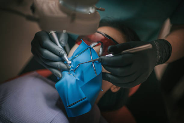 Asian chinese male dentist looking through microscope on patient's teeth in dentist's office Root canal treatment Asian chinese male dentist looking through microscope on patient's teeth in dentist's office Root canal treatment surgical light stock pictures, royalty-free photos & images